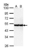 Anti-STK40 antibody [N3C3] used in Western Blot (WB). GTX111337