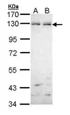 Anti-EphB6 antibody [C2C3], C-term used in Western Blot (WB). GTX111340