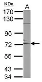 Anti-ADAM10 antibody [N1N2], N-term used in Western Blot (WB). GTX111347