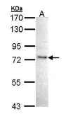 Anti-IKK epsilon antibody [C2C3], C-term used in Western Blot (WB). GTX111350