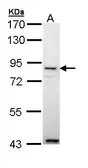 Anti-Angiopoietin 4 antibody [N1N3] used in Western Blot (WB). GTX111353