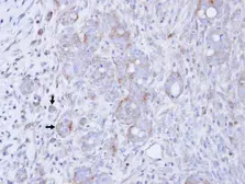 Anti-DGKG antibody [C1C3] used in IHC (Paraffin sections) (IHC-P). GTX111375