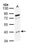 Anti-p38 beta antibody [N3C3] used in Western Blot (WB). GTX111388