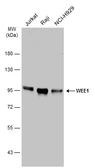 Anti-WEE1 antibody [N3C2], Internal used in Western Blot (WB). GTX111392