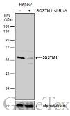 Anti-SQSTM1 / P62 antibody used in Western Blot (WB). GTX111393