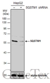 Anti-SQSTM1 / P62 antibody used in Western Blot (WB). GTX111393