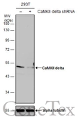 Anti-CaMKII delta antibody used in Western Blot (WB). GTX111401