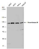 Anti-Hexokinase III antibody [C1C3-2] used in Western Blot (WB). GTX111409