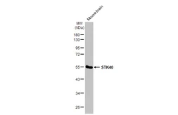 Anti-STK40 antibody [N1N3] used in Western Blot (WB). GTX111412