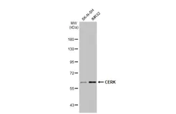 Anti-CERK antibody used in Western Blot (WB). GTX111420