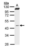 Anti-MVD antibody [N1C1] used in Western Blot (WB). GTX111425