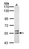Anti-FRK antibody used in Western Blot (WB). GTX111430