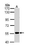 Anti-MPP2 antibody [C1C3] used in Western Blot (WB). GTX111438