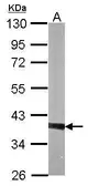 Anti-PTK9 antibody used in Western Blot (WB). GTX111439