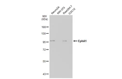 Anti-EphA1 antibody [C1C3-2] used in Western Blot (WB). GTX111449