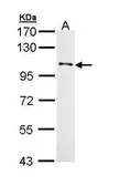Anti-DDR1 antibody [N1N3] used in Western Blot (WB). GTX111453