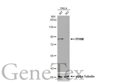 Anti-PFKM antibody [N1N2-2], N-term used in Western Blot (WB). GTX111461