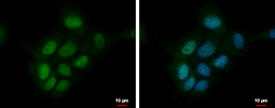 Anti-PRKCBP1 antibody used in Immunocytochemistry/ Immunofluorescence (ICC/IF). GTX111462