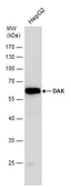 Anti-DAK antibody used in Western Blot (WB). GTX111471