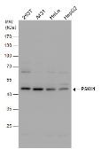 Anti-PSKH1 antibody used in Western Blot (WB). GTX111473