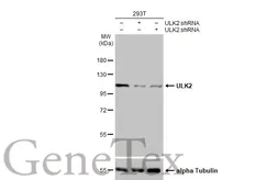 Anti-ULK2 antibody [C2C3], C-term used in Western Blot (WB). GTX111476