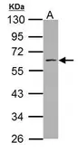 Anti-SSH3BP1 antibody used in Western Blot (WB). GTX111478