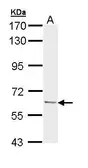 Anti-Ubiquilin 1 antibody [N1C1] used in Western Blot (WB). GTX111485