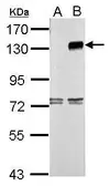 Anti-TLR9 antibody [N3C2], Internal used in Western Blot (WB). GTX111490