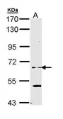 Anti-ELP3 antibody [N1C1] used in Western Blot (WB). GTX111492