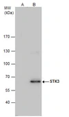Anti-STK3 antibody used in Immunoprecipitation (IP). GTX111494