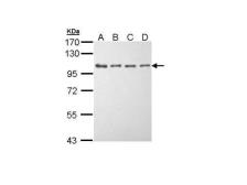 Anti-eEF2K antibody [N1N3] used in Western Blot (WB). GTX111496