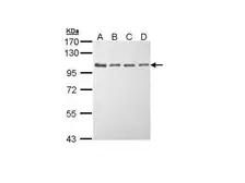 Anti-eEF2K antibody [N1N3] used in Western Blot (WB). GTX111496