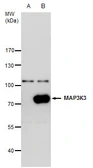 Anti-MEKK3 antibody [N3C2], Internal used in Western Blot (WB). GTX111498