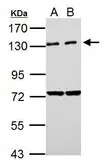 Anti-PKN2 antibody used in Western Blot (WB). GTX111499