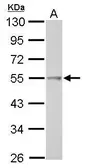 Anti-TRIP6 antibody [N3C3] used in Western Blot (WB). GTX111504