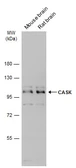 Anti-CASK antibody used in Western Blot (WB). GTX111513