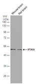 Anti-IP3KA antibody [N2C3] used in Western Blot (WB). GTX111539