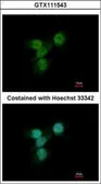 Anti-LYN antibody [N2C3] used in Immunocytochemistry/ Immunofluorescence (ICC/IF). GTX111543