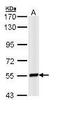 Anti-LYN antibody [N2C3] used in Western Blot (WB). GTX111543
