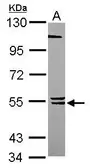 Anti-BLK antibody [N1C1] used in Western Blot (WB). GTX111546