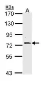 Anti-FAF1 antibody [C1C3] used in Western Blot (WB). GTX111553