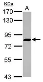Anti-FYB antibody [N3C3] used in Western Blot (WB). GTX111564