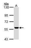 Anti-ADCK4 antibody [N2C3] used in Western Blot (WB). GTX111571
