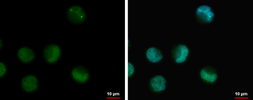 Anti-IRAK3 antibody used in Immunocytochemistry/ Immunofluorescence (ICC/IF). GTX111573
