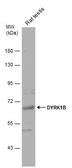 Anti-DYRK1B antibody used in Western Blot (WB). GTX111575