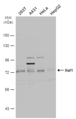 Anti-Raf1 antibody [N1C1-2] used in Western Blot (WB). GTX111588