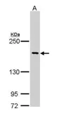 Anti-Bcr antibody [C2C3-2], C-term used in Western Blot (WB). GTX111591