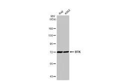 Anti-BTK antibody used in Western Blot (WB). GTX111592