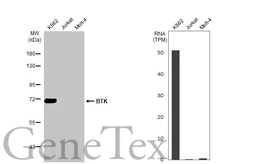 Anti-BTK antibody used in Western Blot (WB). GTX111592