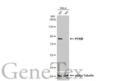 Anti-PFKM antibody [C1C3] used in Western Blot (WB). GTX111597
